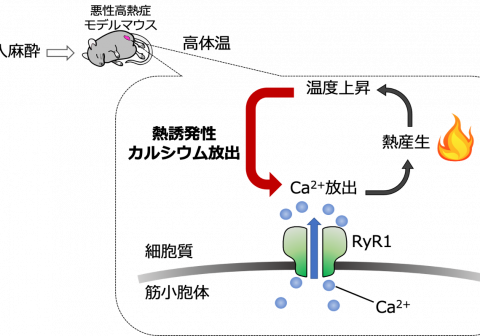 悪性高熱症を単一細胞レベルで再現することに世界で初めて成功！ ~吸入麻酔薬や筋弛緩薬投与後の体温上昇メカニズム解明へ期待~