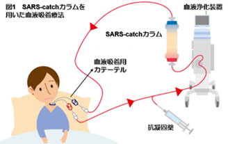 新型コロナウイルスに対する新しいウイルス吸着療法 ～重症COVID19患者の人工呼吸器離脱を改善～